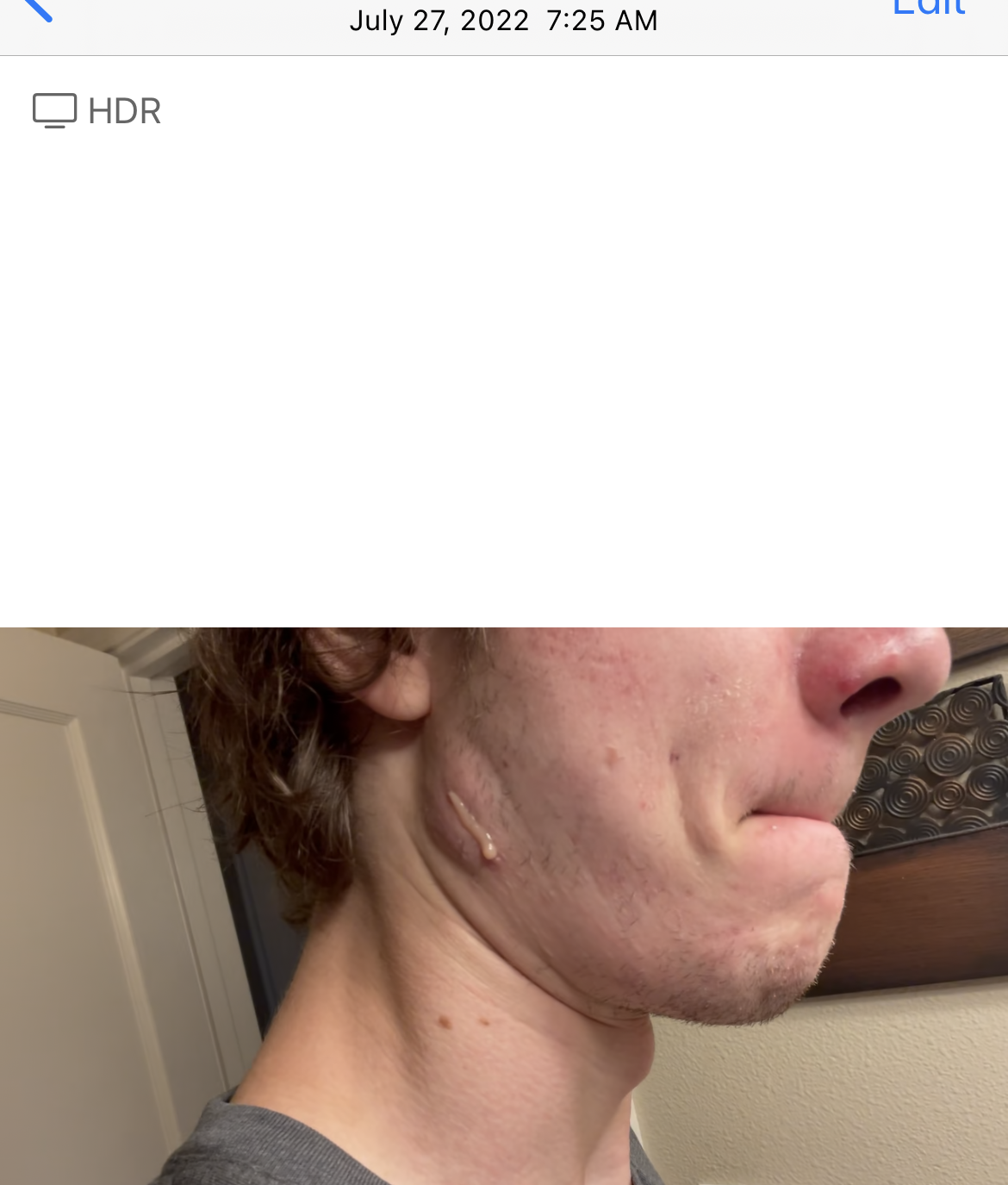 Pasted image 20251121235341.png| 300